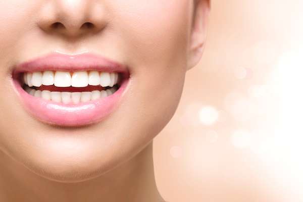 Dental Bonding vs. Contouring from Mission Valley Dental Arts in San Diego, CA