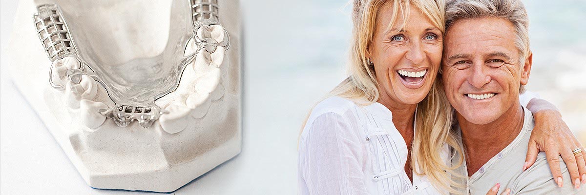 San Diego Dental Crowns