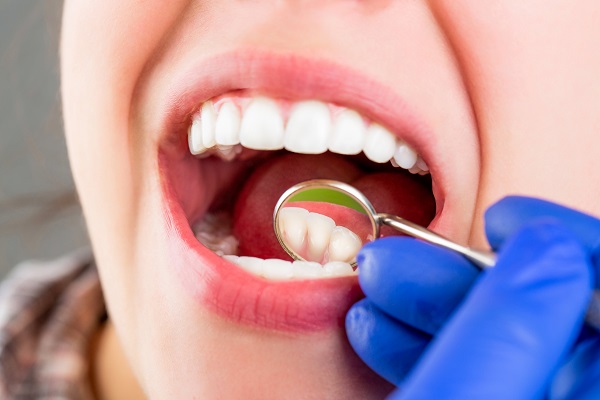 Who Is A Candidate For A Dental Restoration?