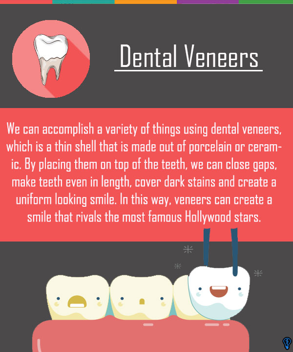 Dental Veneers and Dental Laminates San Diego, CA