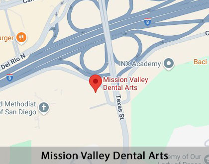 Map image for Dental Crowns and Dental Bridges in San Diego, CA