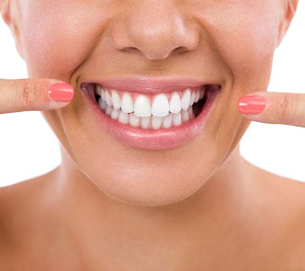 San Diego What Is Gum Contouring and Reshaping