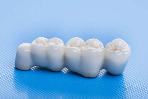 How Many Teeth Can Dental Bridges Replace from Mission Valley Dental Arts in San Diego, CA