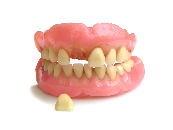 Different Options For Replacing Missing Teeth